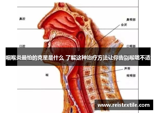 咽喉炎最怕的克星是什么 了解这种治疗方法让你告别喉咙不适
